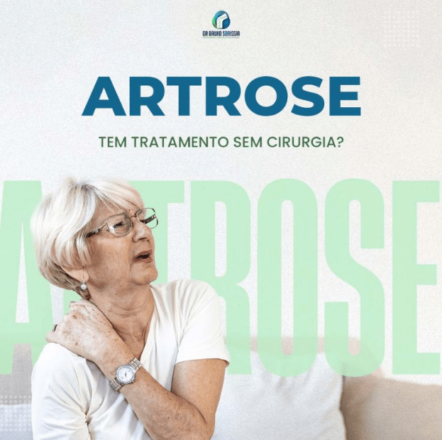 Artrose Tem Tratamento Sem Cirurgia Tratamento Do Joelho Em Curitiba